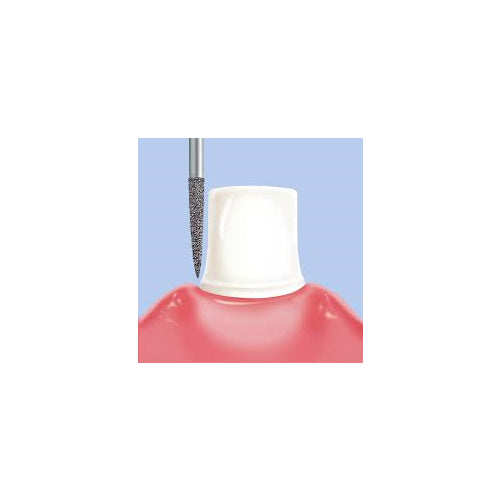 Abrasive Technology 703.8KRZ Two Striper ZTECH Diamond Burs 5/Pk 2015894 Abrasive Technology 703.8KRZ Two Striper ZTECH Diamond Burs 5/Pk 2015894